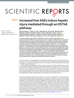 Increased liver AGEs induce hepatic injury mediated through an OST48 pathway