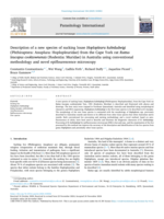 Description of a new species of sucking louse Hoplopleura kuhnludwigi (Phthiraptera: Anoplura: Hoplopleuridae) from the Cape York rat Rattus leucopus cooktownensis (Rodentia: Muridae) in Australia using conventional methodology and novel epiflourescence microscopy