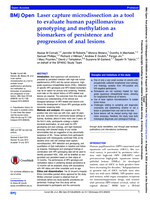 Laser capture microdissection as a tool to evaluate human papillomavirus genotyping and methylation as biomarkers of persistence and progression of anal lesions