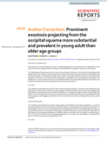 Author Correction: Prominent exostosis projecting from the occipital squama more substantial and prevalent in young adult than older age groups