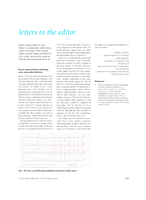 Severe hypercalcaemia mimicking acute myocardial infarction
