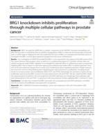 BRG1 knockdown inhibits proliferation through multiple cellular pathways in prostate cancer