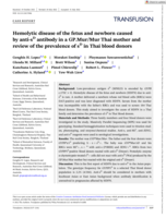 Hemolytic disease of the fetus and newborn caused by anti-sD antibody in a GP.Mur/Mur Thai mother and review of the prevalence of sD in Thai blood donors