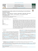 Quantifiable brain atrophy synthesis for benchmarking of cortical thickness estimation methods