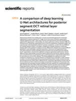 A comparison of deep learning U-Net architectures for posterior segment OCT retinal layer segmentation