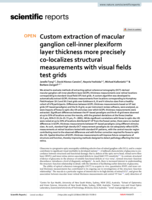 Custom extraction of macular ganglion cell-inner plexiform layer thickness more precisely co-localizes structural measurements with visual fields test grids