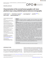 Characterisation of the normal human ganglion cell-inner plexiform layer using widefield optical coherence tomography
