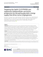 Targeting the SphK1/S1P/PFKFB3 axis suppresses hepatocellular carcinoma progression by disrupting glycolytic energy supply that drives tumor angiogenesis